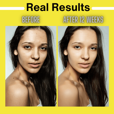 Brightening & Glowing Routine for Brighter & Youthful Skin